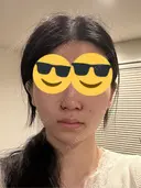 小鼻縮小（切開） くさのたろうクリニック DAY 0 サムネイル用