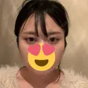 ボトックス（エラ・小顔） フィラークリニック 大阪心斎橋院 DAY 1 サムネイル用