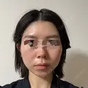 糸リフト / 脂肪吸引（顔） / ジョールファット除去 A CLINIC（エークリニック） 横浜院 AFTER サムネイル用