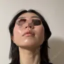 糸リフト / 脂肪吸引（顔） / ジョールファット除去 A CLINIC（エークリニック） 横浜院 DAY 14 サムネイル用