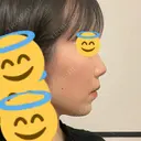 セットバック カトレア歯科・美容クリニック DAY 210 サムネイル用