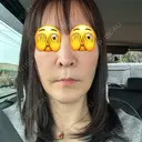 肌ヒアルロン酸注入（たるみ・シワ改善） TCB東京中央美容外科 姫路院 AFTER サムネイル用