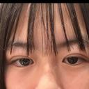 二重埋没 湘南美容クリニック 千葉センシティ院 DAY 1 サムネイル用