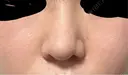 隆鼻術 / 鼻尖形成（切開） / 鼻中隔延長（切開） / 軟骨移植 / 鼻孔縁挙上 / 鼻翼基部形成（貴族手術） / 鼻柱下降・鼻唇角形成（猫手術） 4Dクリニック AFTER サムネイル用