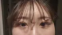 二重埋没 HAAB×DREAM BEAUTY CLINIC 大阪梅田院 DAY 8 サムネイル用