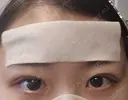 二重埋没 HAAB×DREAM BEAUTY CLINIC 大阪梅田院 DAY 9 サムネイル用