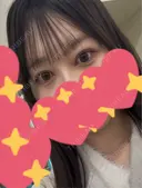 目頭切開 Brandnew Beauty Clinic DAY 132 サムネイル用