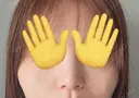 小鼻縮小（切開） / その他（鼻） EMMO FACE CLINIC 東京三田院 DAY 6 サムネイル用