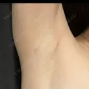 豊胸（シリコンバッグ） / 胸修正 / その他（胸） お茶の水美容形成クリニック AFTER サムネイル用