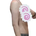 糸リフト / 脂肪吸引（顔） / 脂肪吸引（二の腕） / ワキ汗治療（切開） / 脂肪吸引注射（顔） ICON CLINIC DAY 31 サムネイル用