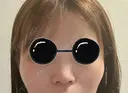 小鼻縮小（切開） / その他（鼻） EMMO FACE CLINIC 東京三田院 DAY 8 サムネイル用