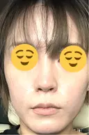 光治療（フォトフェイシャルなど） メディカルアルファクリニック DAY 12 サムネイル用