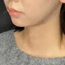 糸リフト / 脂肪吸引（顔） THE FIRST CLINIC 多摩センター院 AFTER サムネイル用