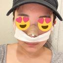 鼻尖形成（切開） / 小鼻縮小（切開） / その他（鼻） / 軟骨移植 / 毛穴洗浄（ハイドラフェイシャルなど） KARIS beauty clinic DAY 1 サムネイル用