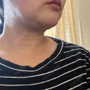 その他（輪郭） YAYOI CLINIC AFTER サムネイル用