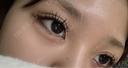 ヒアルロン酸注入（涙袋） / ボトックス（エラ・小顔） Code Beauty Clinic 名古屋院 DAY 1 サムネイル用
