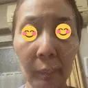 ルメッカ BAO CLINIC 神戸院 DAY 3 サムネイル用