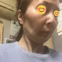 ルメッカ BAO CLINIC 神戸院 DAY 3 サムネイル用