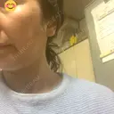 ルメッカ BAO CLINIC 神戸院 DAY 3 サムネイル用