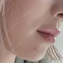 ヒアルロン酸注入（唇） Wi Clinic （ウィ クリニック）心斎橋院 DAY 0 サムネイル用