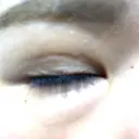 二重埋没 / 自然癒着法 Brandnew Beauty Clinic DAY 6 サムネイル用