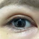 二重埋没 / 自然癒着法 Brandnew Beauty Clinic DAY 7 サムネイル用