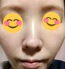 美肌レーザー みやた形成外科・皮ふクリニック DAY 11 サムネイル用