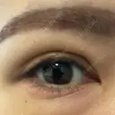 二重埋没 / 自然癒着法 Brandnew Beauty Clinic DAY 8 サムネイル用