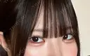 二重埋没 / 目頭切開 / 上まぶたの脂肪取り 9BeautyClinic AFTER サムネイル用