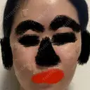 ほくろ・いぼ切除（肌） あいちビューティークリニック DAY 1 サムネイル用