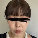 鼻尖形成（切開） / 小鼻縮小（切開） / 軟骨移植 ASTRA BEAUTY CLINIC DAY 19 サムネイル用