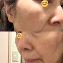 ルメッカ BAO CLINIC 神戸院 AFTER サムネイル用