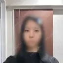 目頭切開 / 小鼻縮小（切開） / 鼻尖形成（非切開） アネシス美容クリニック DAY 18 サムネイル用