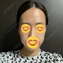 その他（肌） / ポテンツァ ゆう美容クリニック AFTER サムネイル用