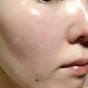 美肌レーザー みやた形成外科・皮ふクリニック DAY 12 サムネイル用