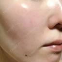 美肌レーザー みやた形成外科・皮ふクリニック DAY 12 サムネイル用