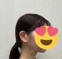 糸リフト / 脂肪吸引（顔） 脂肪吸引ラボトウキョウ DAY 92 サムネイル用
