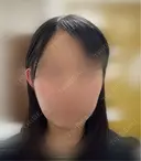 その他（肌） / サーマクール / RF（高周波）たるみ治療 ゆきスキンクリニック 東池袋 AFTER サムネイル用
