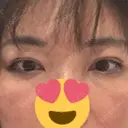 二重埋没 / 目元修正 BELINDA CLINIC（ベリンダクリニック）岡山院 DAY 34 サムネイル用