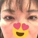 二重埋没 / 目元修正 BELINDA CLINIC（ベリンダクリニック）岡山院 DAY 34 サムネイル用
