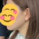 脂肪溶解注射（顔） フォンタナクリニック天神 DAY 4 サムネイル用