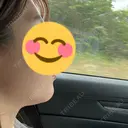 脂肪溶解注射（顔） フォンタナクリニック天神 DAY 4 サムネイル用
