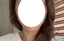 糸リフト Stand by Beauty Clinic DAY 3 サムネイル用