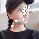 骨削り（頬） FROM B整形外科 (旧バウム整形外科) AFTER サムネイル用