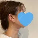 糸リフト / 脂肪吸引（顔） ルラ美容クリニック 札幌本院 DAY 1 サムネイル用