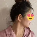 脂肪吸引（顔） / 脂肪吸引（お腹） / 脂肪吸引（腰） / ボトックス（エラ・小顔） Mods Clinic（モッズクリニック） 東京院 DAY 179 サムネイル用