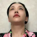 骨切り（あご） / 骨削り（エラ） / 骨削り（頬） / ルフォー+ssro（両あご) id（アイディ）美容外科 DAY 0 サムネイル用