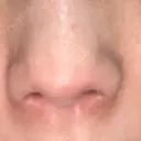 ボトックス（エラ・小顔） / ボトックス（目尻） / ボトックス（人中） 代々木駅前美容クリニック DAY 13 サムネイル用