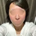 イオン導入 コントアクリニック 東京 DAY 0 サムネイル用