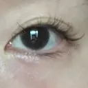 眼瞼下垂（非切開） SOL CLINIC DAY 0 サムネイル用